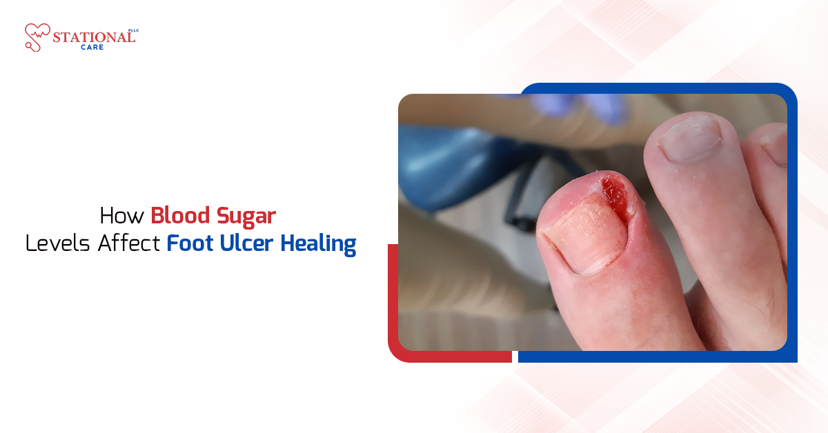 How Blood Sugar Levels Affect Foot Ulcer Healing