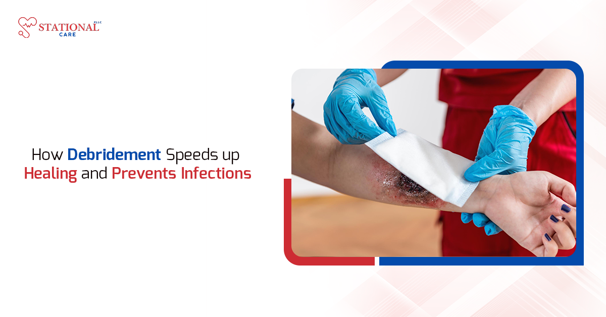 How Debridement Speeds Up Healing and Prevents Infections